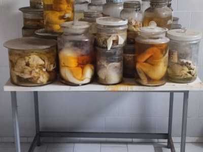 Nel corso degli anni infatti il Policlinico ha raccolto e conservato una serie di organi asportati a malati, tra cui 300 cuori con malformazioni rare. �Oggi questi particolari �cimeli� si trovano nel seminterrato dell�istituto - ci svela il professore mentre ci mostra una foto di essi, tra cui notiamo anche diversi feti -. Vorremmo per� che fossero visibili a tutti, perch� raccontano, assieme a questa aula, della gloriosa storia della Medicina barese�
